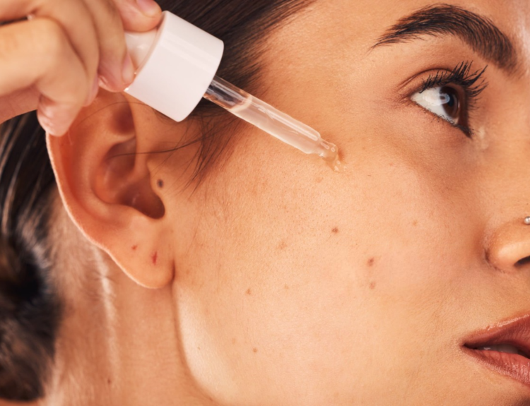 How to Use Acne Serum Without Drying Out Your Skin